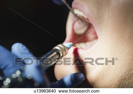 Dental anaesthesia View Large Photo Image Stock Image - Dental anaesthesia. Fotosearch