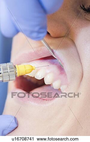 Stock Image - Dental anaesthesia. Fotosearch