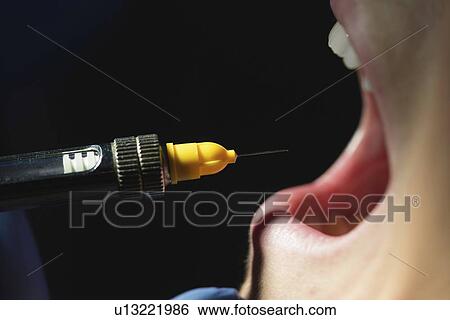 Stock Photograph - Dental anaesthesia. Fotosearch