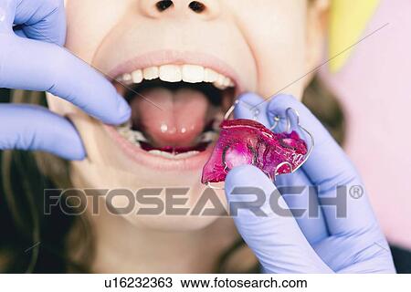 Dental braces View Large Photo Image Stock Image - Dental braces. Fotosearch