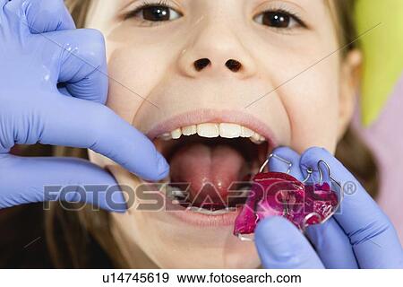 Stock Photo - Dental braces. Fotosearch