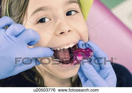 Stock Photograph - Dental braces. Fotosearch