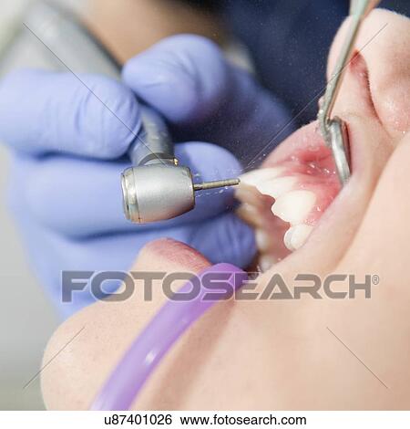 Stock Photograph - Dental drill. Fotosearch
