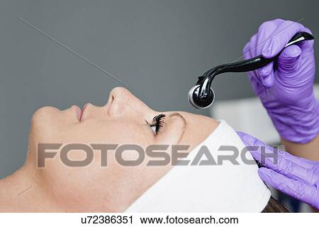 Stock Image - Dermaroller treatment. Fotosearch