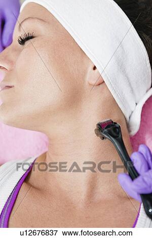 Stock Photo - Dermaroller treatment. Fotosearch