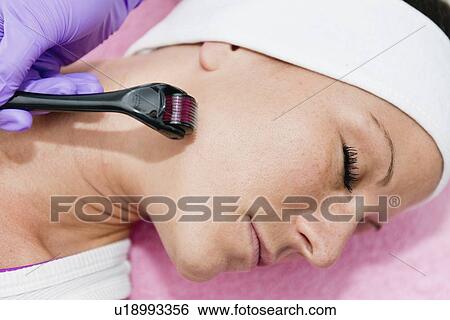 Stock Photograph - Dermaroller treatment. Fotosearch