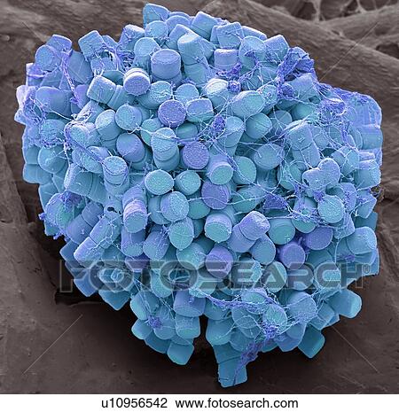 Diatoms. Coloured scanning electron micrograph (SEM) of fresh water centric diatom frustules (skeleton), Diatoms are a type of algae (Chromophyta, Bacillariophyceae). They consist of two valves, made of silica (hydrated silicon dioxide), which fit... View Large Photo Image Stock Image - Diatoms. Coloured scanning electron micrograph (SEM) of fresh water centric diatom frustules (skeleton), Diatoms are a type of algae (Chromophyta, Bacillariophyceae). They consist of two valves, made of silica (hydrated silicon dioxide), which fit.... Fotosearch