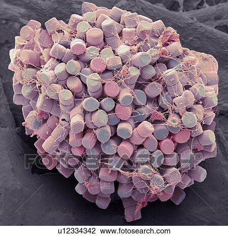Diatoms. Coloured scanning electron micrograph (SEM) of fresh water centric diatom frustules (skeleton), Diatoms are a type of algae (Chromophyta, Bacillariophyceae). They consist of two valves, made of silica (hydrated silicon dioxide), which fit... View Large Photo Image Stock Image - Diatoms. Coloured scanning electron micrograph (SEM) of fresh water centric diatom frustules (skeleton), Diatoms are a type of algae (Chromophyta, Bacillariophyceae). They consist of two valves, made of silica (hydrated silicon dioxide), which fit.... Fotosearch