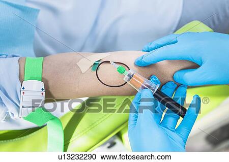 Stock Image - Drawing blood for platelet-rich plasma (PRP) treatment. Close-up of doctor drawing blood for a PRP cosmetics treatment.. Fotosearch