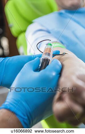 Stock Image - Drawing blood for platelet-rich plasma (PRP) treatment. Doctor drawing blood for a PRP cosmetics treatment.. Fotosearch