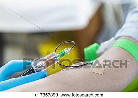 Stock Photo - Drawing blood for platelet-rich plasma (PRP) treatment. Close-up of doctor drawing blood for a PRP cosmetics treatment.. Fotosearch