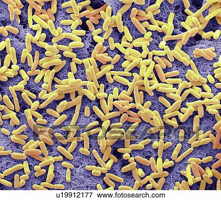 E coli, SEM View Large Photo Image Stock Photo - E coli, SEM. Fotosearch