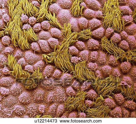 Fallopian tube, SEM View Large Photo Image Stock Image - Fallopian tube, SEM. Fotosearch