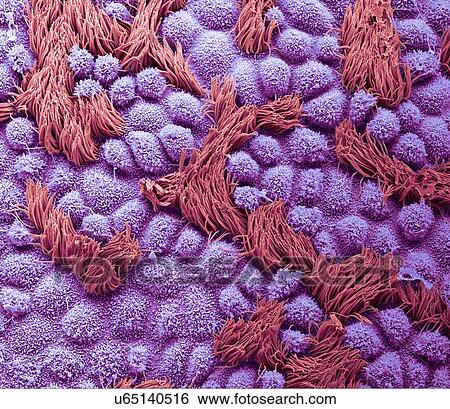 Fallopian tube, SEM View Large Photo Image Stock Photograph - Fallopian tube, SEM. Fotosearch