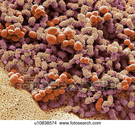 Picture - Foot bacteria, SEM. Fotosearch