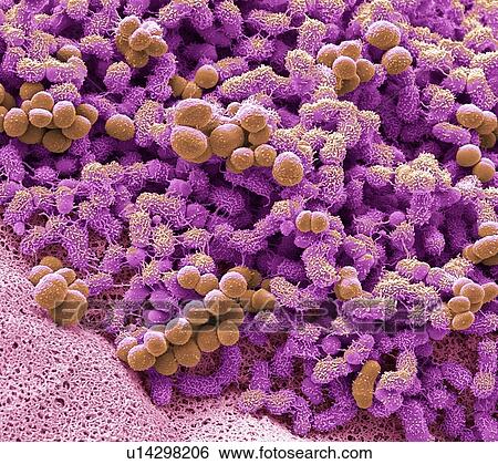 Foot bacteria, SEM View Large Photo Image Stock Photograph - Foot bacteria, SEM. Fotosearch