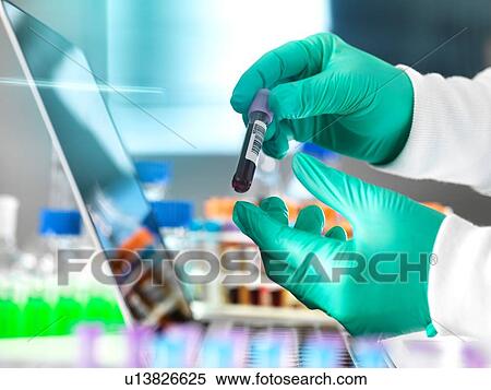 Healthcare screening, researcher examining blood sample and checking with the data on laptop computer, close up of hands View Large Photo Image Stock Photography - Healthcare screening, researcher examining blood sample and checking with the data on laptop computer, close up of hands. Fotosearch