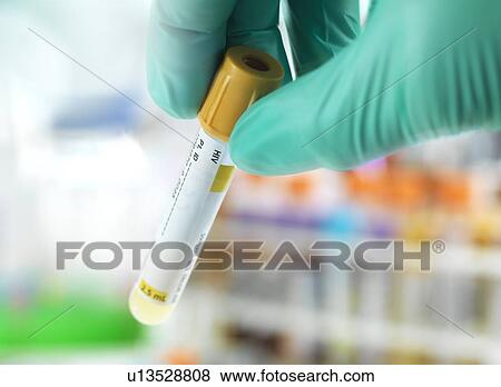 Hiv test View Large Photo Image Stock Photo - Hiv test. Fotosearch