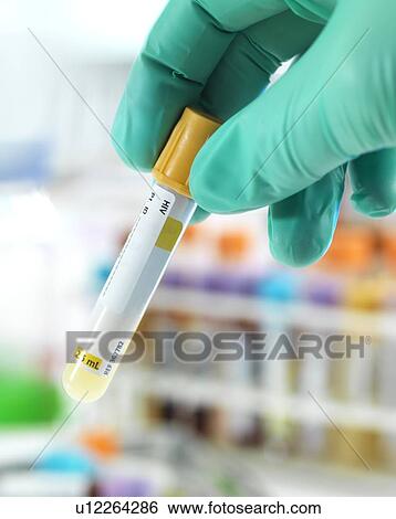 Stock Photograph - Hiv test. Fotosearch