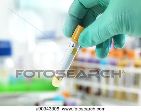 Hiv test View Large Photo Image Stock Photography - Hiv test. Fotosearch