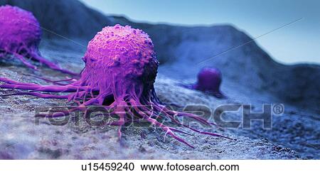 Stock Image - Illustration of a cancer cell. Fotosearch