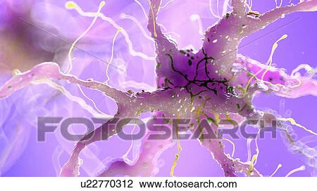 Stock Image - Illustration of a damaged nerve cell. Fotosearch
