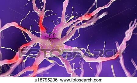 Illustration of a damaged nerve cell View Large Photo Image Stock Photograph - Illustration of a damaged nerve cell. Fotosearch