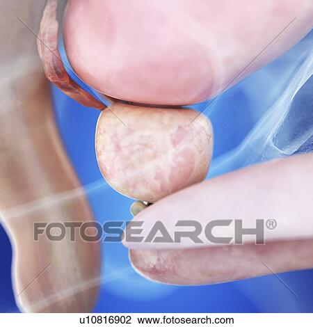 Illustration of a healthy prostate View Large Photo Image Stock Image - Illustration of a healthy prostate. Fotosearch