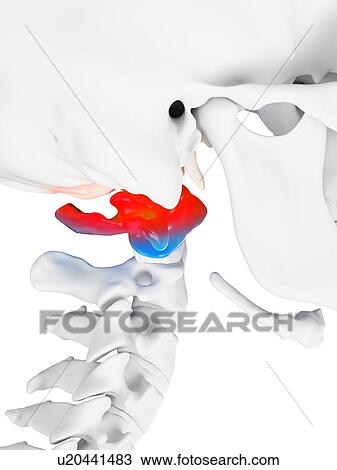 Illustration of a painful atlas bone View Large Photo Image Stock Image - Illustration of a painful atlas bone. Fotosearch