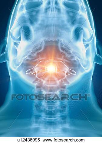 Illustration of a painful atlas bone View Large Photo Image Stock Photography - Illustration of a painful atlas bone. Fotosearch