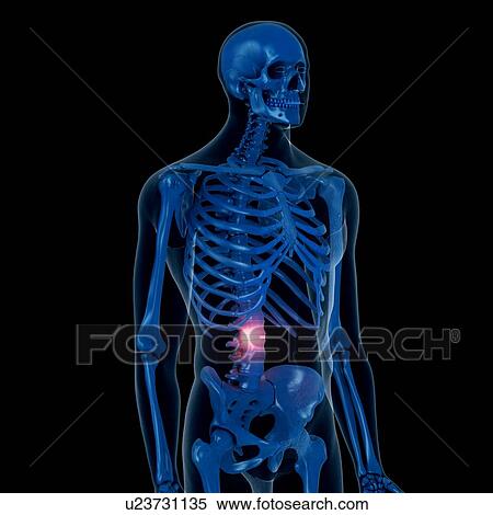 Stock Photography - Illustration of a painful back. Fotosearch