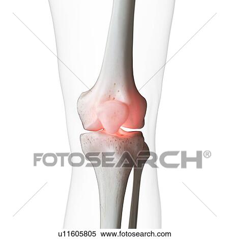 Stock Photography - Illustration of a painful knee. Fotosearch