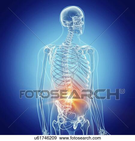 Illustration of a painful lumbar spine View Large Photo Image Stock Photo - Illustration of a painful lumbar spine. Fotosearch