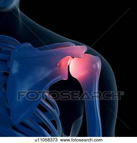 Illustration of a painful shoulder View Large Photo Image Stock Image - Illustration of a painful shoulder. Fotosearch