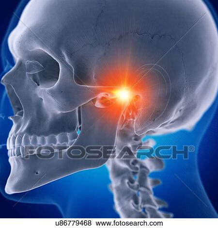 Illustration of a painful temporomandibular joint View Large Photo Image Stock Photo - Illustration of a painful temporomandibular joint. Fotosearch