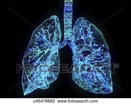 Illustration of a plexus lung View Large Photo Image Stock Image - Illustration of a plexus lung. Fotosearch