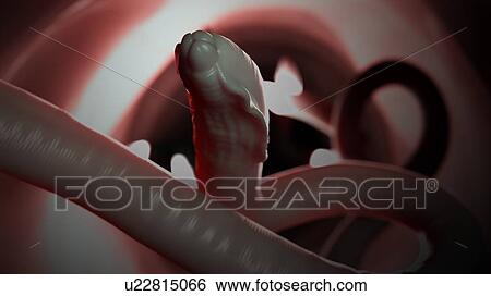 Stock Photograph - Illustration of a roundworm. Fotosearch