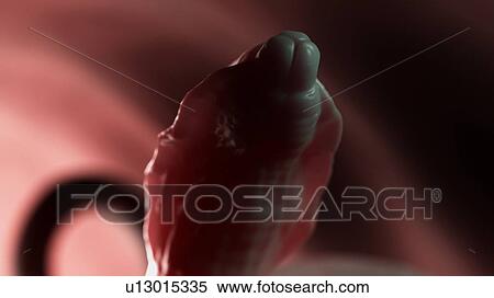 Stock Photography - Illustration of a roundworm. Fotosearch