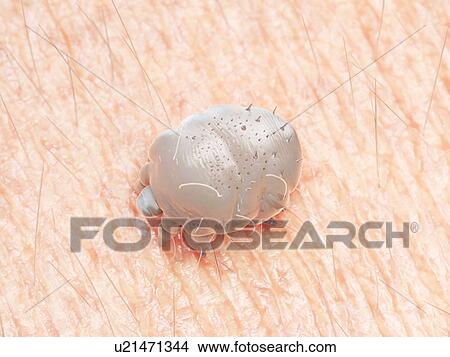 Picture - Illustration of a scabies mite. Fotosearch