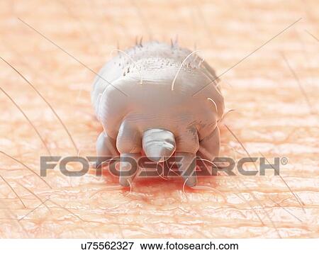 Stock Photo - Illustration of a scabies mite. Fotosearch