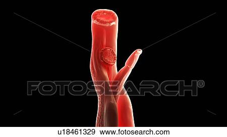 Stock Photo - Illustration of a schistosoma. Fotosearch