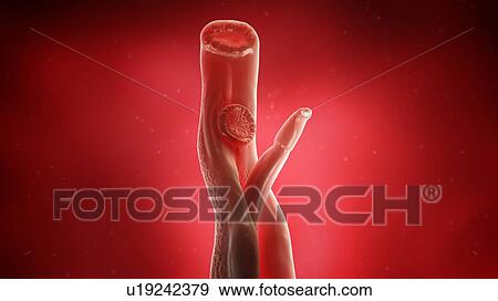 Illustration of a schistosoma View Large Photo Image Stock Photo - Illustration of a schistosoma. Fotosearch