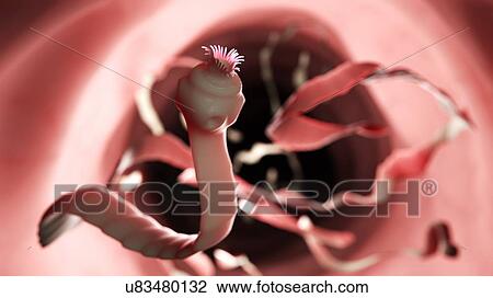 Stock Image - Illustration of a tapeworm. Fotosearch