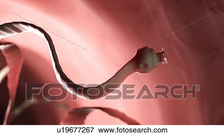 Illustration of a tapeworm View Large Photo Image Stock Photo - Illustration of a tapeworm. Fotosearch
