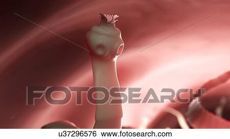 Stock Photograph - Illustration of a tapeworm. Fotosearch