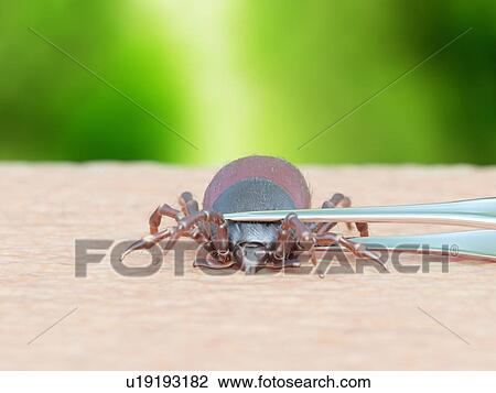 Stock Image - Illustration of a tick being removed. Fotosearch