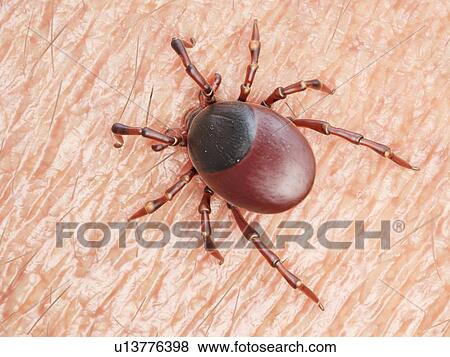 Illustration of a tick biting human skin View Large Photo Image Stock Photo - Illustration of a tick biting human skin. Fotosearch