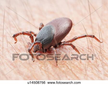 Illustration of a tick biting human skin View Large Photo Image Stock Photograph - Illustration of a tick biting human skin. Fotosearch