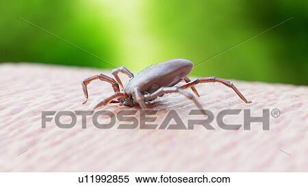 Illustration of a tick biting View Large Photo Image Stock Photography - Illustration of a tick biting. Fotosearch