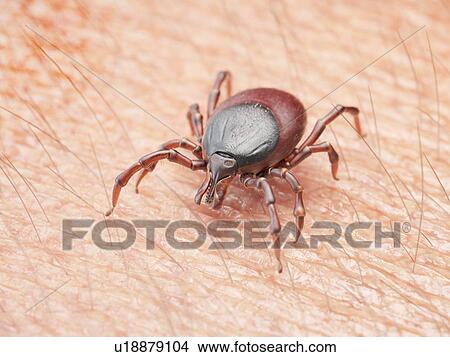 Illustration of a tick crawling on human skin View Large Photo Image Picture - Illustration of a tick crawling on human skin. Fotosearch